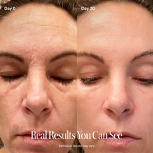 Load image into Gallery viewer, 4-in-1 Red Light Therapy Wand &amp; Activating Serum Kit