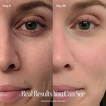 Load image into Gallery viewer, 4-in-1 Red Light Therapy Wand &amp; Activating Serum Kit